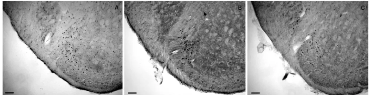 Fig. 4. Effects of pretreatment with L-NAME on IL-1β-induced c- c-fos like immunoreactive neurons
