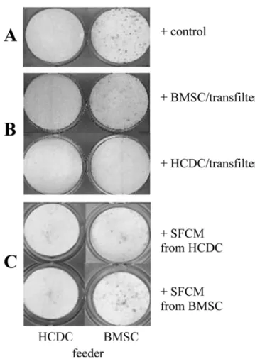 Fig. 2. Western blot for OPG. Western blot analysis was used to assess the levels of OPG protein in serum-free conditioned medium (SFCM) of BMSC and HCDC.