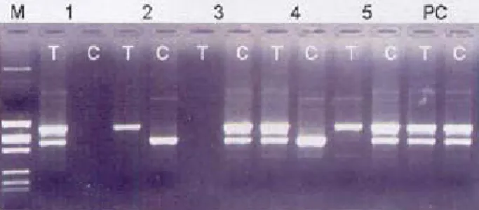 Fig.  1.  Electrophoresis  of  ApoE  PCR  product.