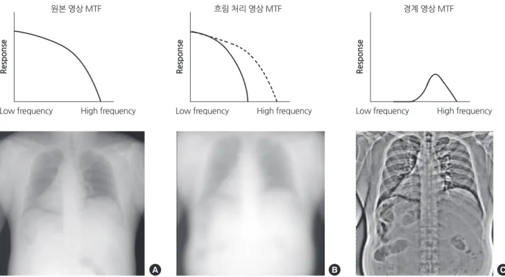 Fig. 3.  Multi-Frequency Processing (MFP). 원본 영상(A)에 가우시안 커널(Gaussian Kernel)을 콘볼루션 처리해 흐림 영상(B)을 얻는다