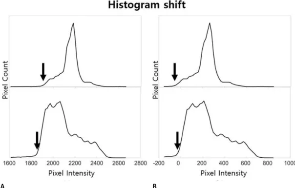 Fig. 3. (A) before histogram shift and (B) after histogram shift. The black arrows indicate the 2 percentile histogram.