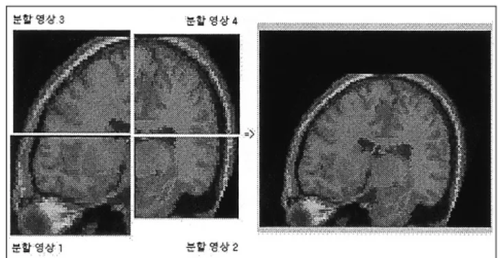 Fig. 7. 분할 영상들의reconstruction