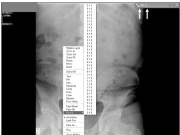 Table 1. Outside CD contents analysis