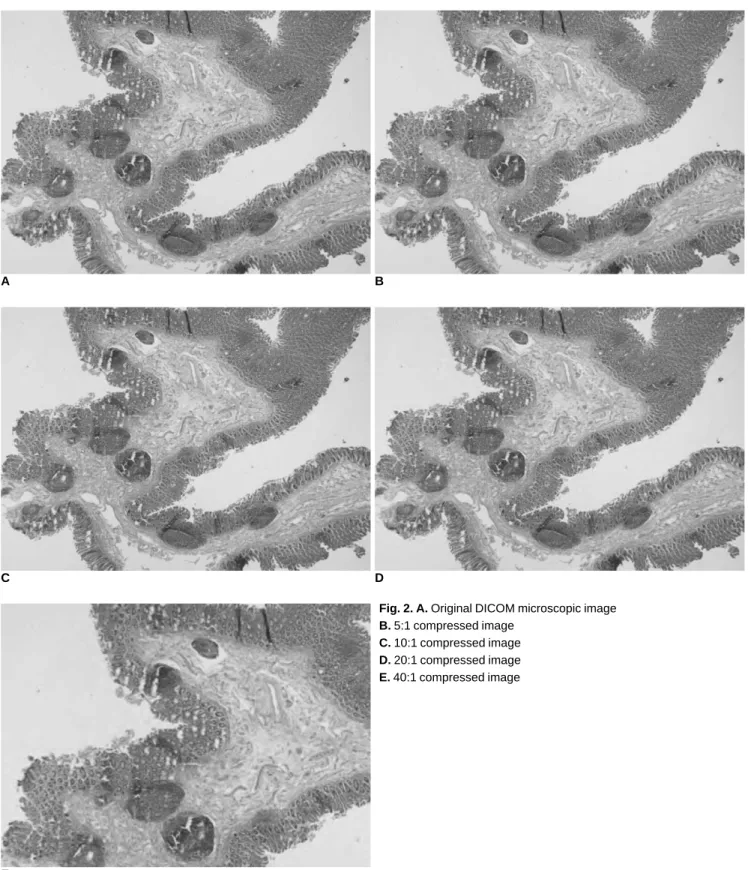 Fig. 2. A. Original DICOM microscopic image B. 5:1 compressed image