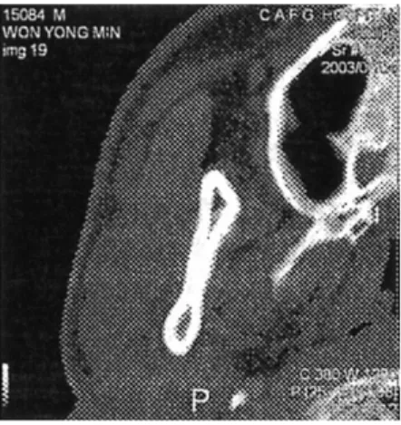 Fig. 5. 확대 Fig. 6. 이동