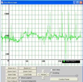 Fig  6.  Acceleration  Sensor  Result