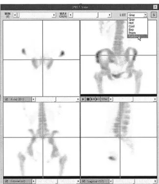 Fig. 2. (a)는 기존 PACS 뷰어에서 SPECT 영상의 단층영상을 보인 화면으로 버튼“M” 을 클릭할 때 , (b)와 같은 SPECT 뷰어가 다이얼로그 형태로 나타난