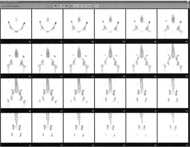 Fig. 3. SPECT  뷰어에서 시상(Coronal) 영상의 뷰윈도우에서 더블클릭을 했을 때, 시상영상들을 생성하여6×4 형식으로 보여준다.