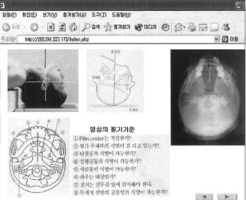 Fig. 5. Reference of radiographic in bones of skull