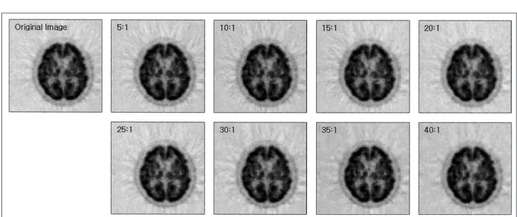 Fig. 3. JPEG 압축 비율별 PET brain 영상