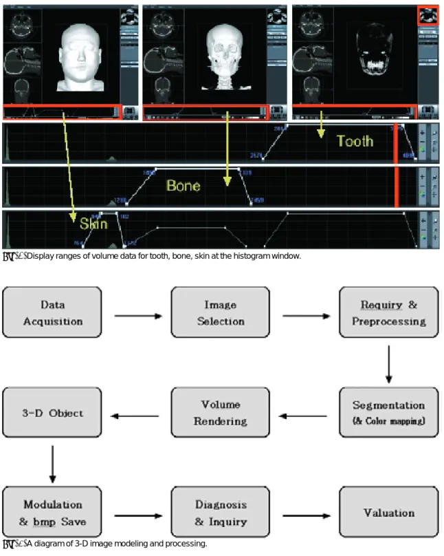 Fig. 3. Display ranges of volume data for tooth, bone, skin at the histogram window.