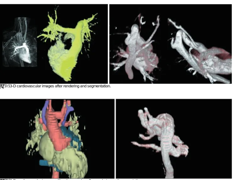 Fig. 5. 3-D cardiovascular images after rendering and segmentation.