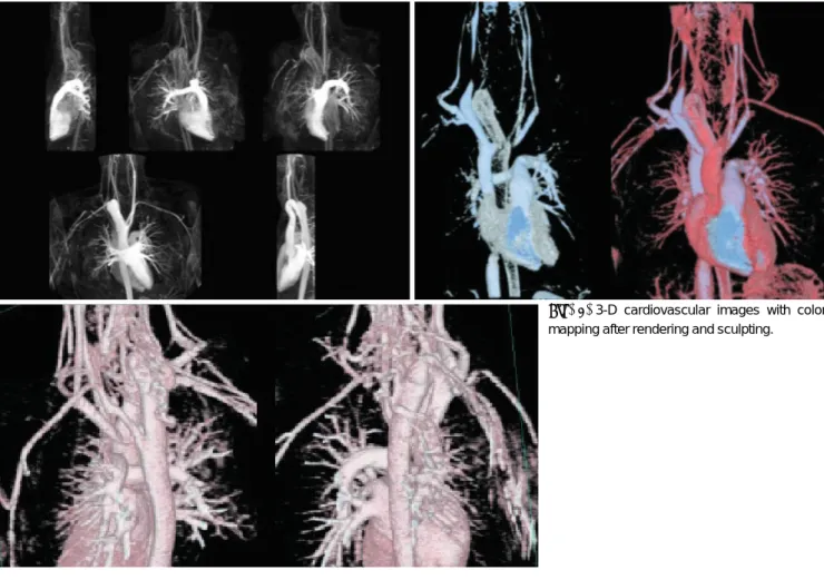 Fig. 7. 3-D cardiovascular images with color mapping after rendering and sculpting.