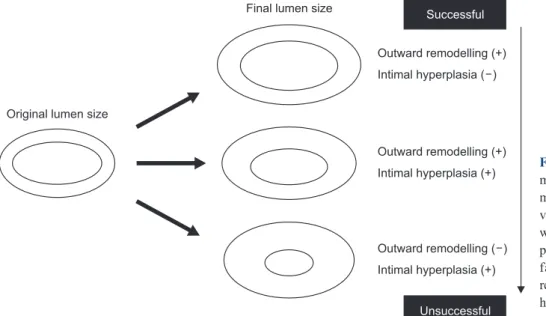 Fig. 1. The diagram shows the  manner in which remodeling can  modify the cross-sections of blood  vessels