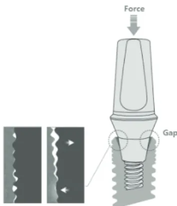 Fig. 2  Gap occurrence in an abutment against external  force 