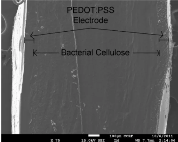Fig. 5 X-ray Diffraction patterns of bacterial cellulose  and ionic liquid treated bacterial cellulose 