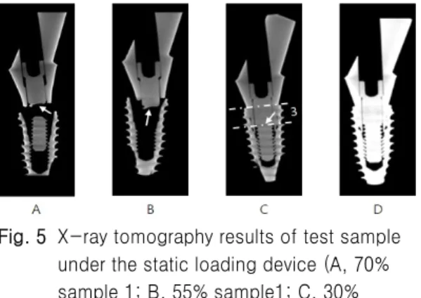 Fig. 5  X-ray tomography results of test sample  under the static loading device (A, 70% 