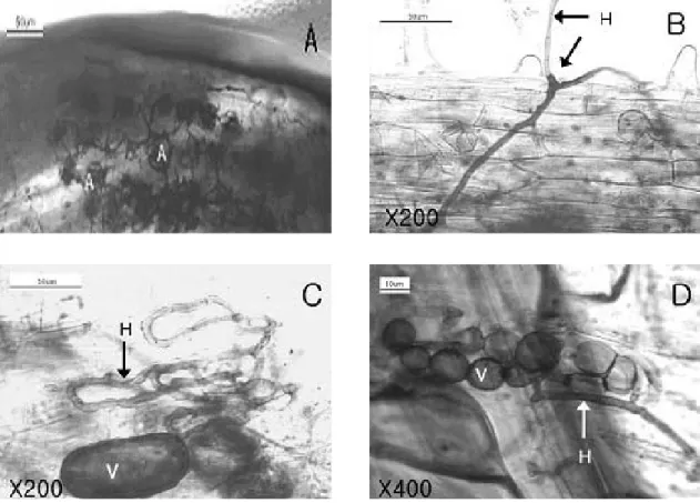 Fig. 3. Colonization pattern of AMF in the minute roots of Ginseng.