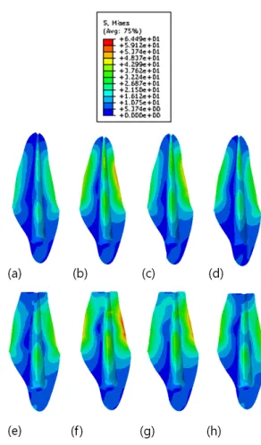 Fig. 3 Maximum Von Mises stresses of the various  alveolar bone resorption models in dentin 