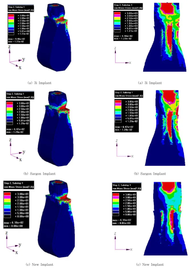 Fig. 13 von Mises stress contour occurring in inner  vertical section for load case 2(unit: MPa)