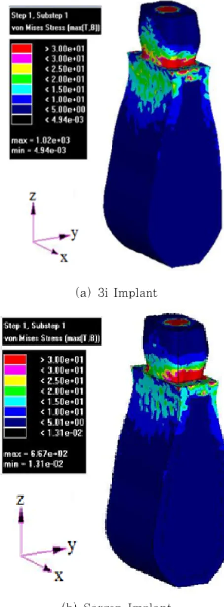 Fig. 9 von Mises stress contour occurring in whole  structure for load case 1(unit: MPa)