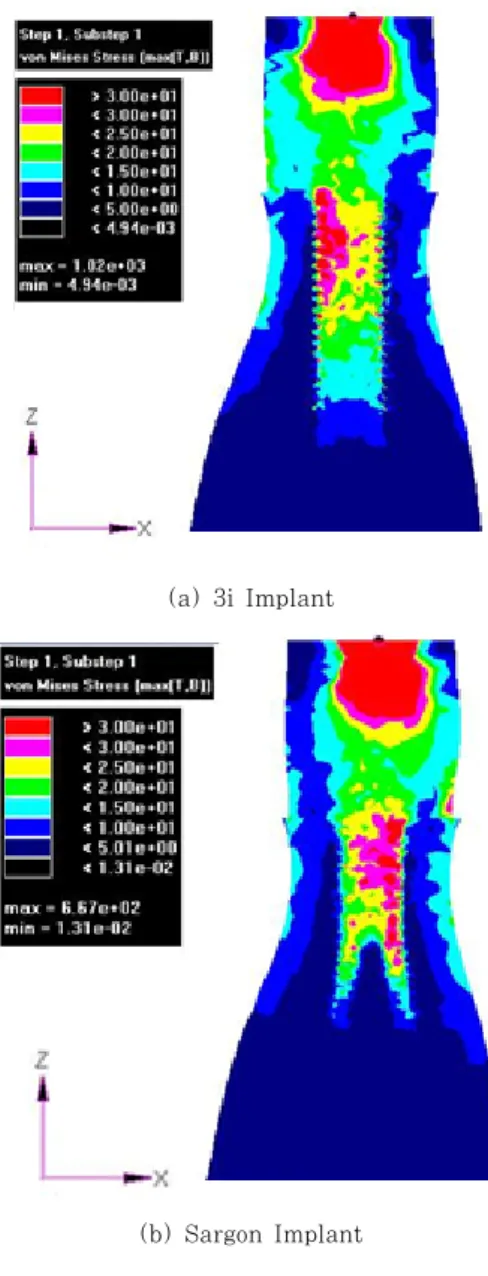 Fig. 10 von Mises stress contour occurring in inner  vertical section for load case 1(unit: MPa)