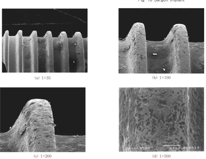 Fig. 10 Sargon implant