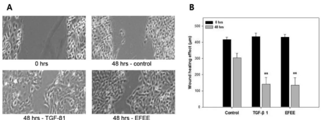 Fig. 2. Pictures (A) of wound healing effect (B) in HaCaT cells by in vitro scratch assay