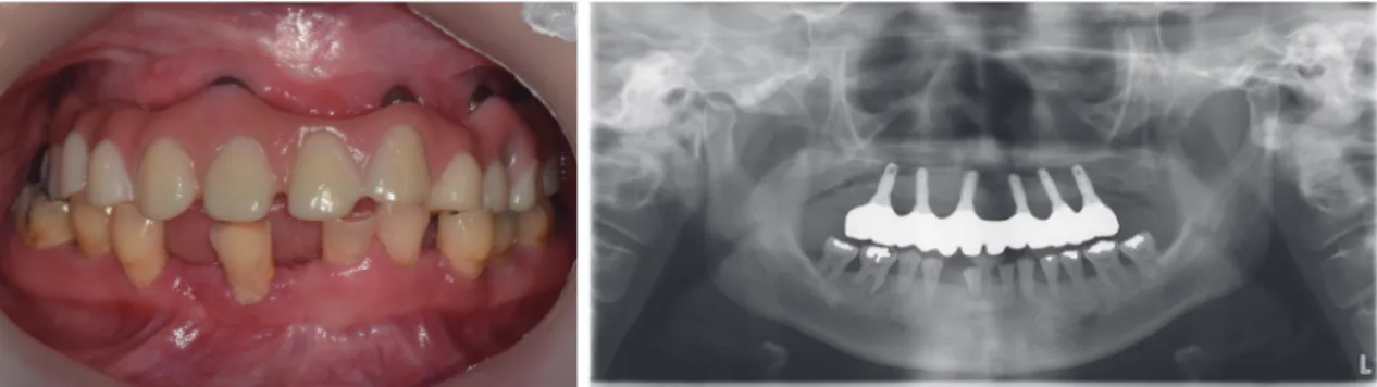Fig. 15. Follow up check (After 1 year).