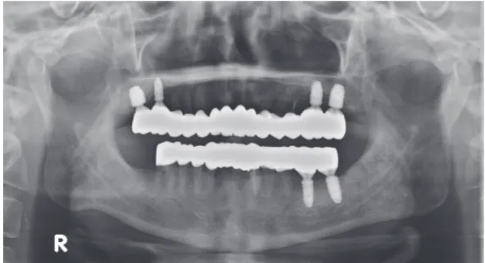 Fig. 9. Postoperative panoramic radiographic image.