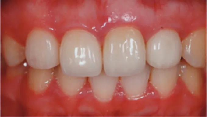Fig. 6. Final prosthesis setting.