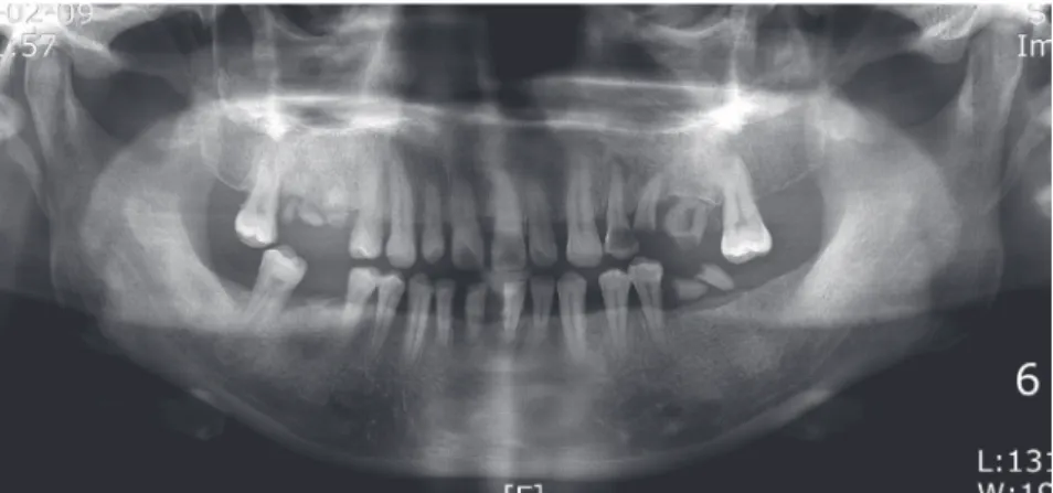 Fig. 2. Pretreatment panoramic radiograph.