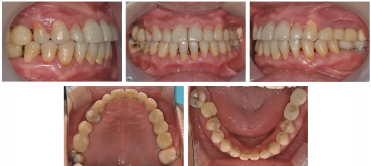 Fig. 10. Posttreatment intraoral photos.