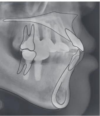 Fig. 12. Superimposition of pretreatment and 