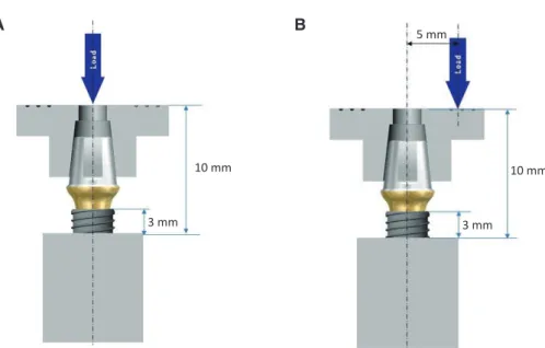 Fig. 4. Diagram of testing setup. Implants were embedded into resin filled cylinder and metal T-bar allowed a force  application at center (A) and 5 mm off-center (B).