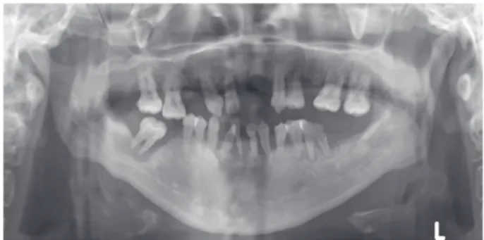 Fig. 2. Preoperative intraoral view. (A) Maxilla, (B) Mandible. 