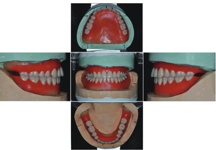 Fig. 10. Arrangement of artificial teeth.