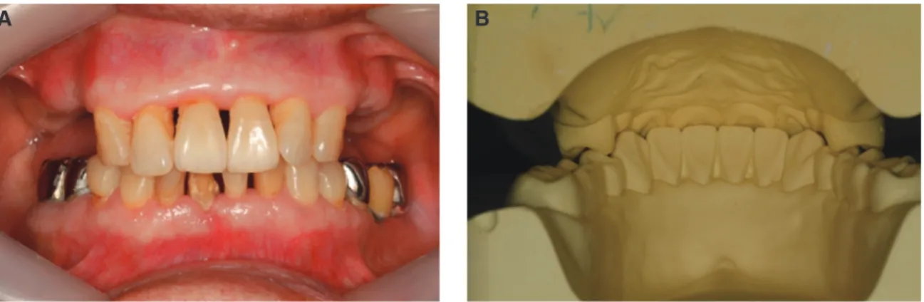 Fig. 3. Several checklist of teeth and tissue area from diagnostic cast.