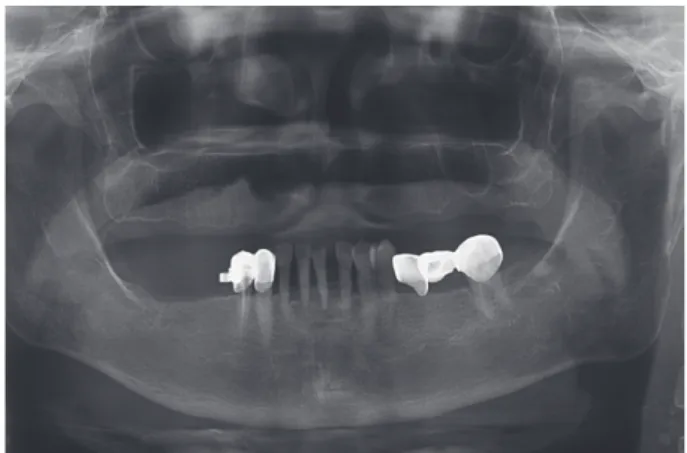 Fig. 1. Initial intraoral photo.  Fig. 2. Panoramic view.