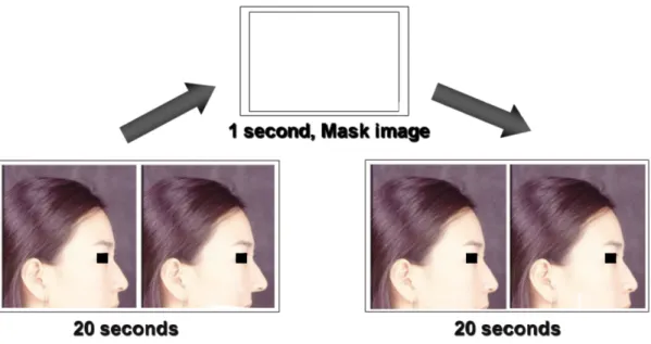 Fig. 5. The sequence of image presentation. A mask image was interposed between the 2 target images to eliminate optical persistence memory.
