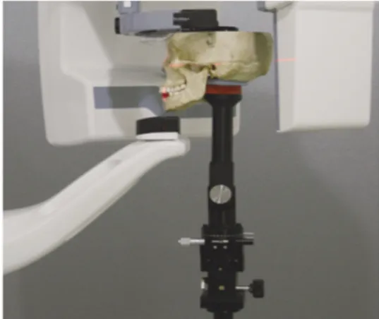 Fig. 1. Mounted skull in the dental panoramic X-ray machine.