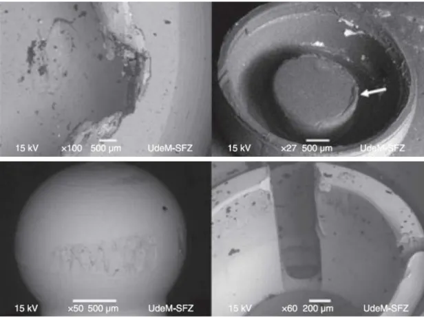 Fig. 4. SEM micrographs of a ball-socket attachment (upper) and Locator attachment (lower) following 400000 loads