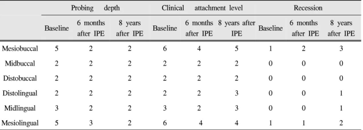 Table Ⅱ. Clinical evaluation of right mandibular second molar at baseline and after intentional passive eruption (IPE) 었고 환자 불편감도 소실되었으며 이후 3개월 간격으로 유지관리기 치료를 시행하여 8년간 양 호한 결과를 유지하고 있으며 (Fig