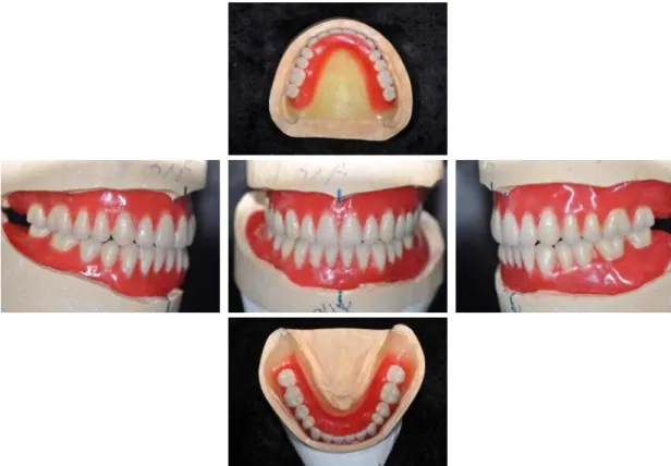 Fig. 11. Artificial teeth arrangement.