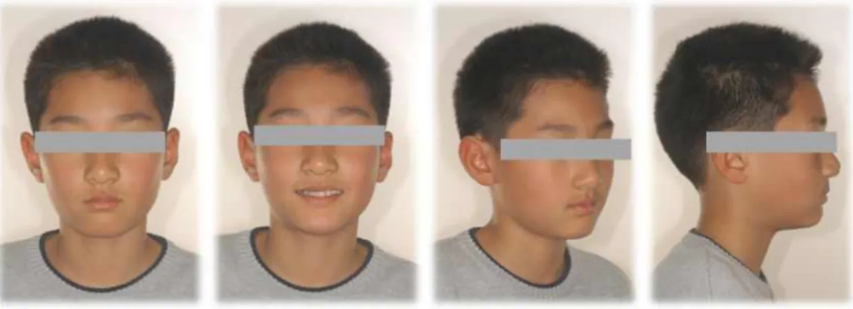 Fig. 2. Initial facial photos.