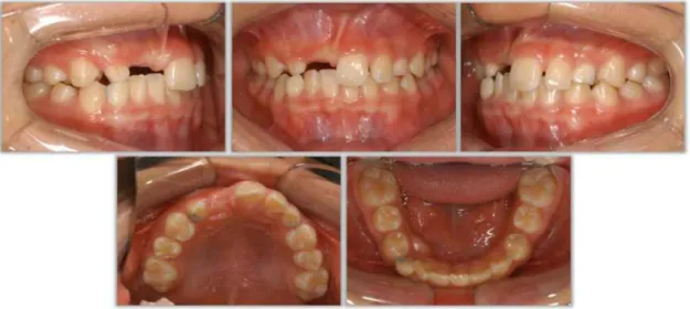 Fig. 3. Initial intra-oral photos.