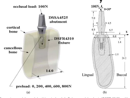 Fig. 1. Geometry model used in this study. (a) Submerged implant (DSFR4310) with DSSA4525 abutment placed in the mandibular bone of 14 mm in length is subject to a occlusal load of 100N