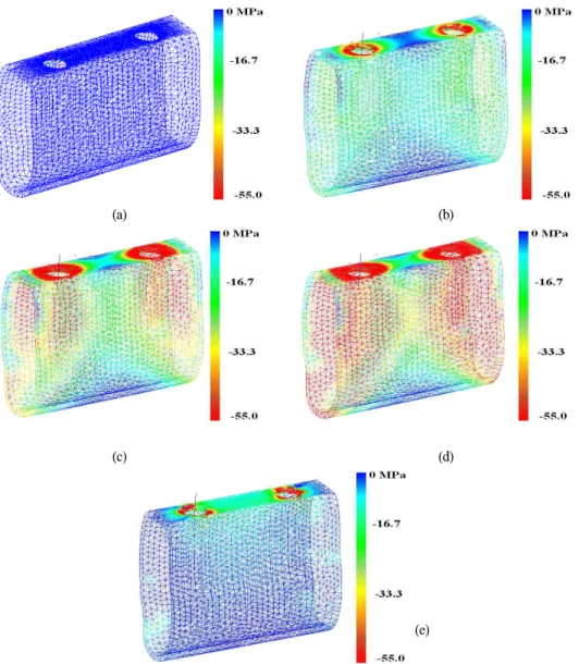 Fig. 6. Stress (maximim compressive stress) development in the cortical bone with the course of fixed prosthodontics/abutment assembly when the fixed prosthodontics is longer than the inter abutment distance by 0.1mm