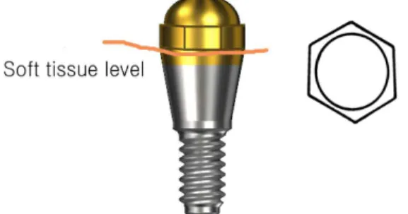 Fig. 3. Ideal shape of the abutment in implant assisted removable partial denture.