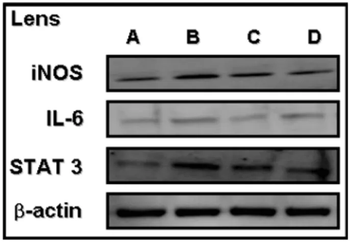 Fig. 6.  Expression of iNOS, IL-6, STAT3 protein by western blotting in the lens. Actin was used as on internal control
